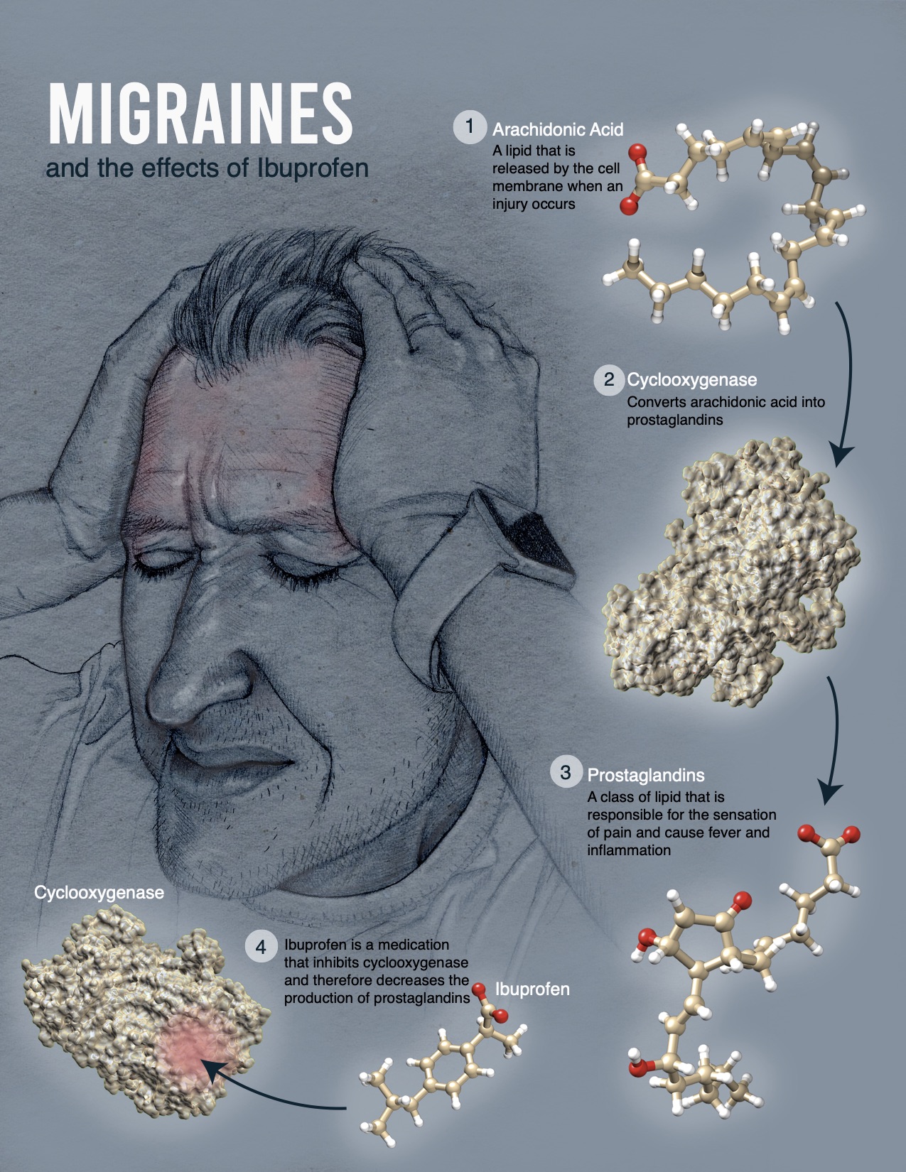 An illustration showing the symptoms and science behind migraines.