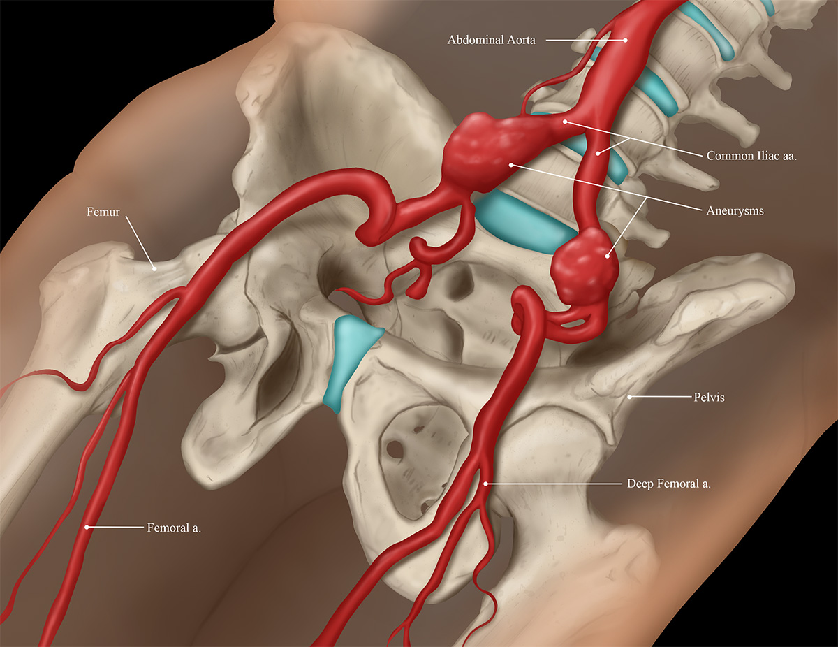 An illustration of bones in the pelvic area.