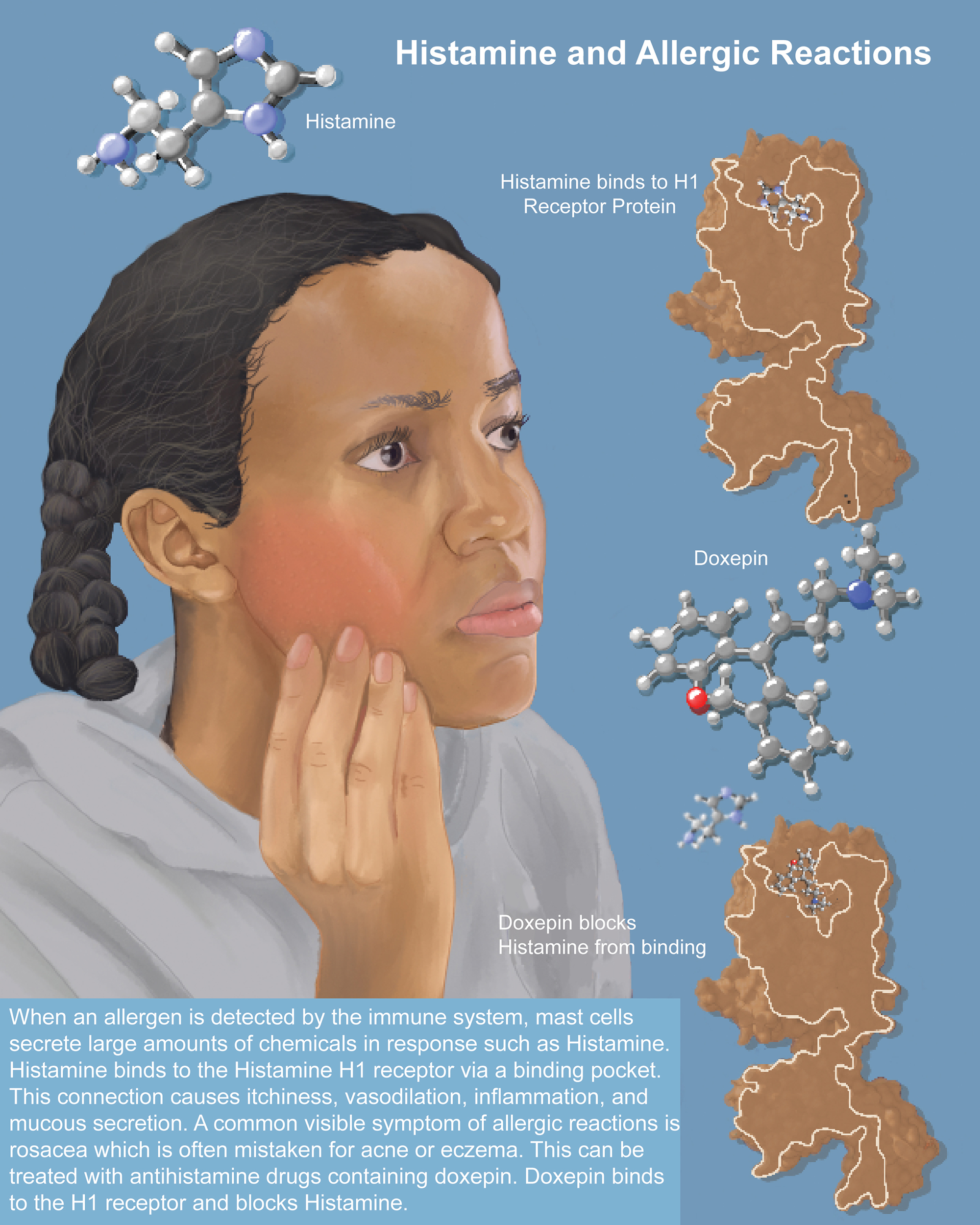 An illustration of an allergic reaction.