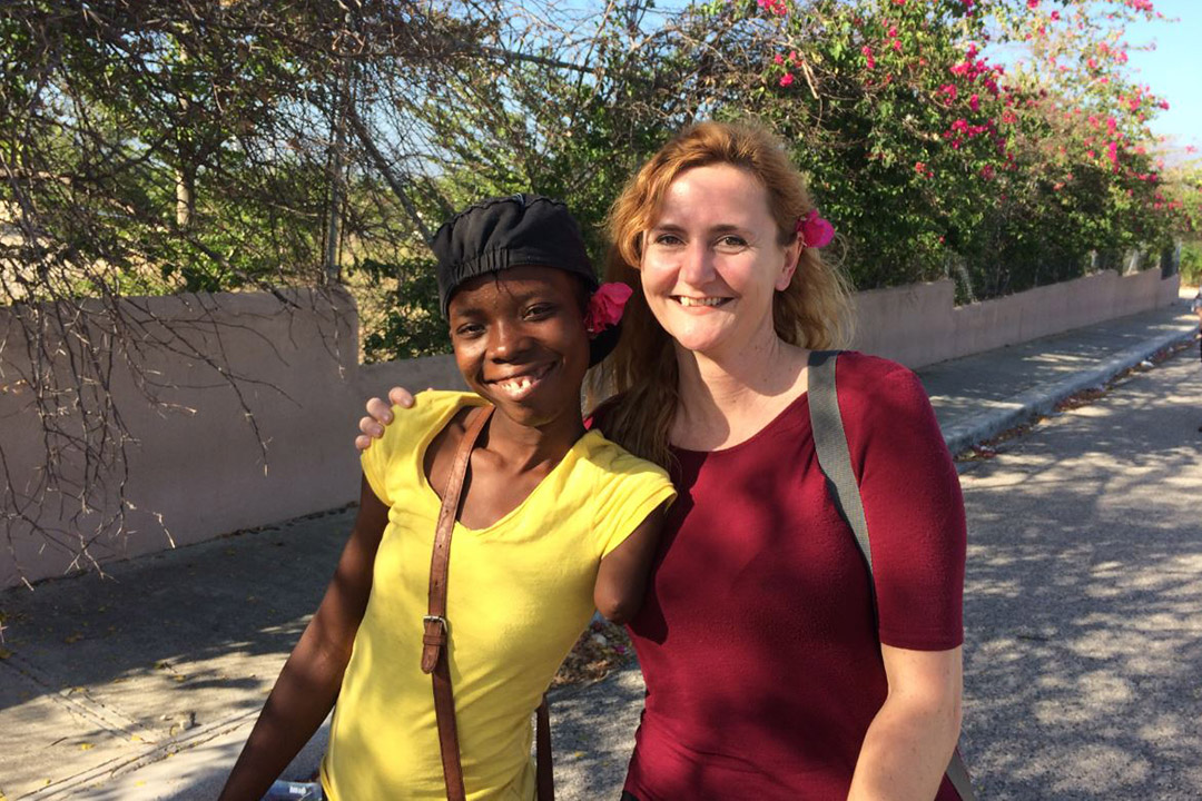 two women posing for a photo, one of whom is missing part of her arm.