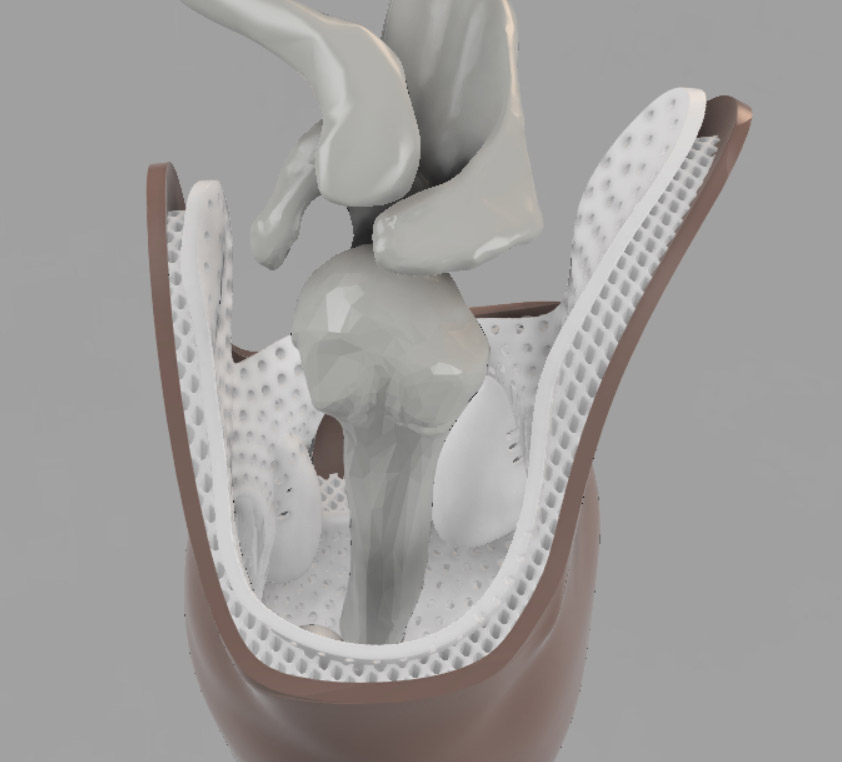 rendering of a lattice structure to support a prosthesis.