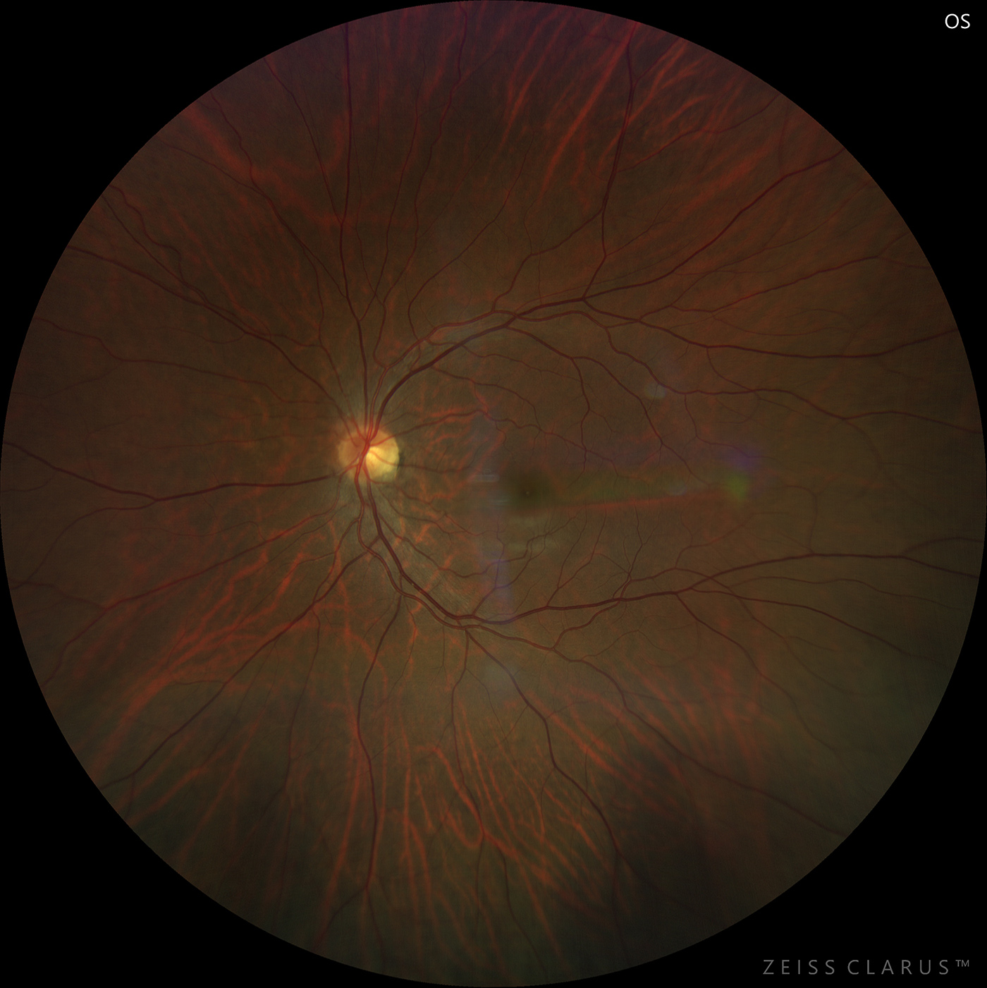 An ophthalmic image, showing a retina.