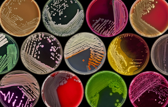 Picture of petri dishes