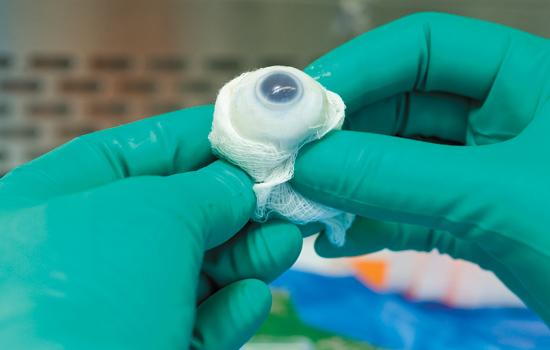 image of eyeball in gauze.