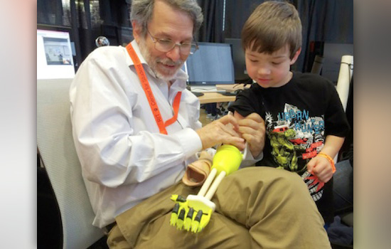 People working on prosthetics arm