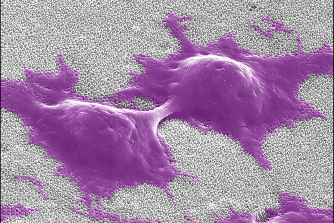 cells sitting on top of a carbon nanotube.