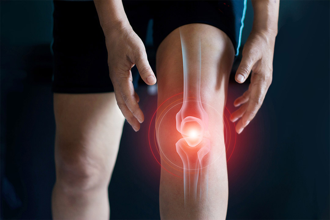 photo illustration of knee pain.