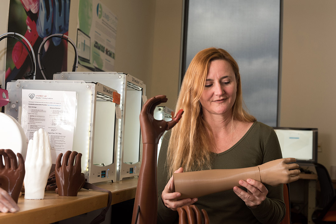 Person holding and showing other arm and hand prosthetic.