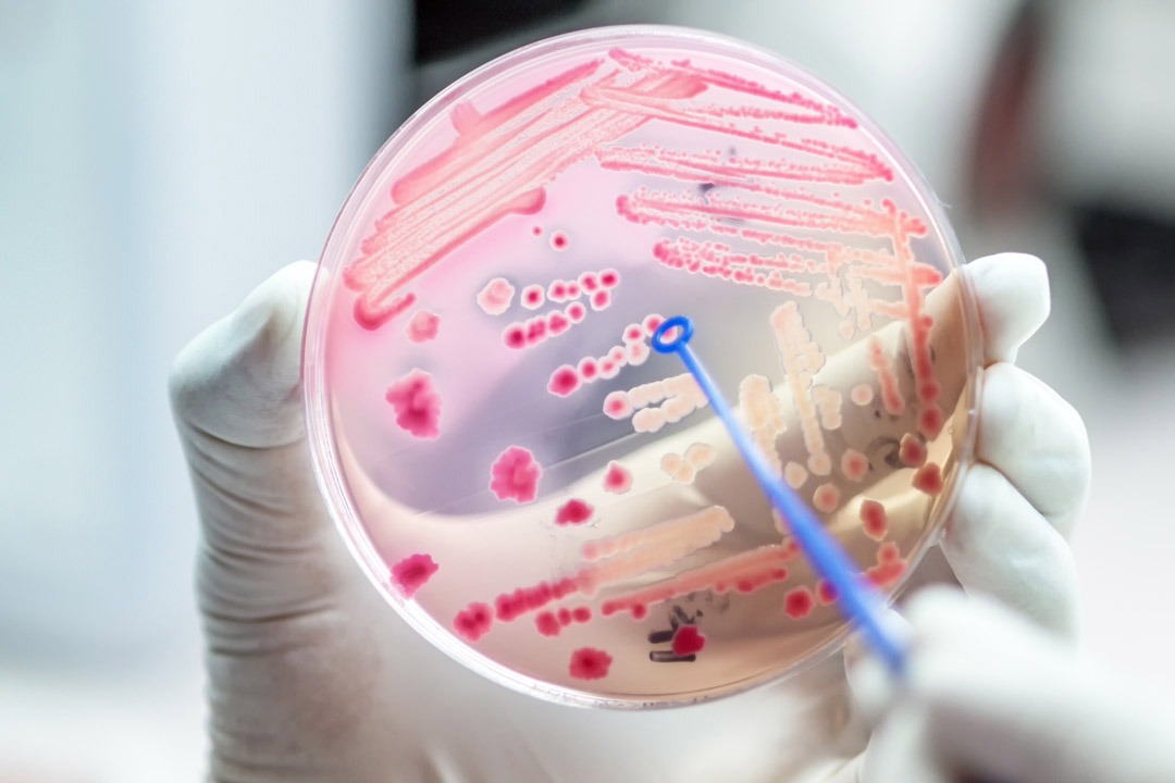 pink bacteria is shown in a slide behind held by a white gloved hand