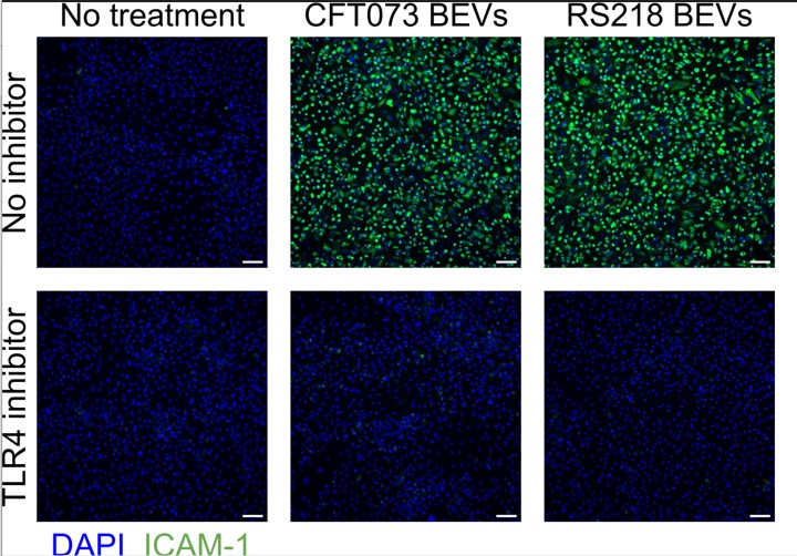 image of fluorescence microscopy that compares cells with and without treatment